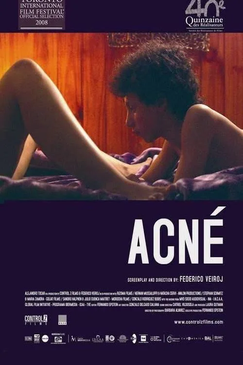 Póster de Acné